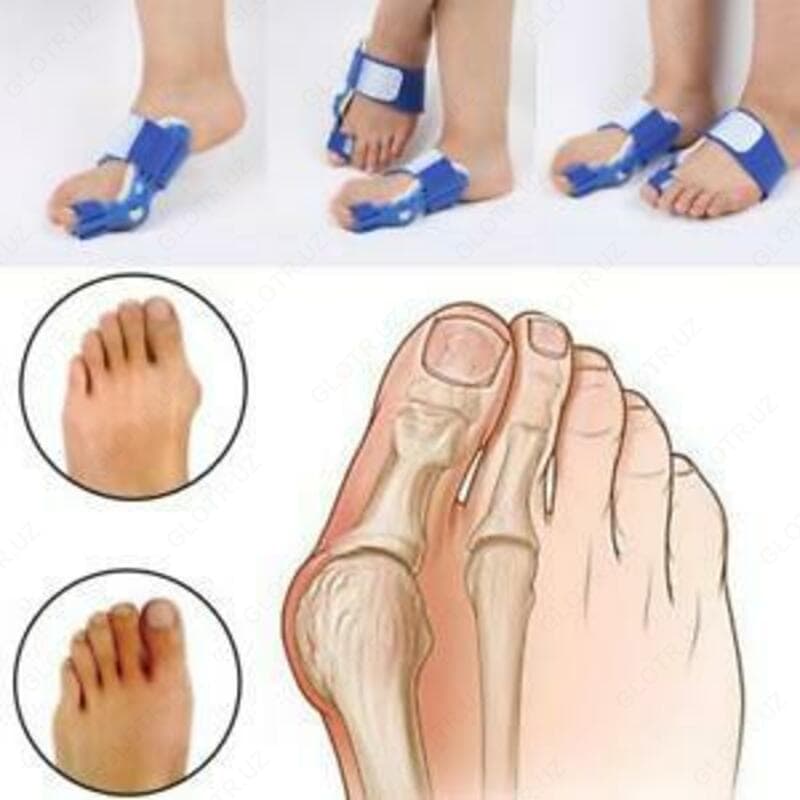 Ортопедический корсет Hallufix Hallux Valgus Schiene — 2