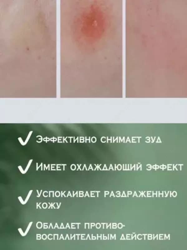 Портативный бальзам после укусов насекомых «Окопник таун» — 3