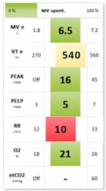 ELISA 600 Аппарат ИВЛ — 3