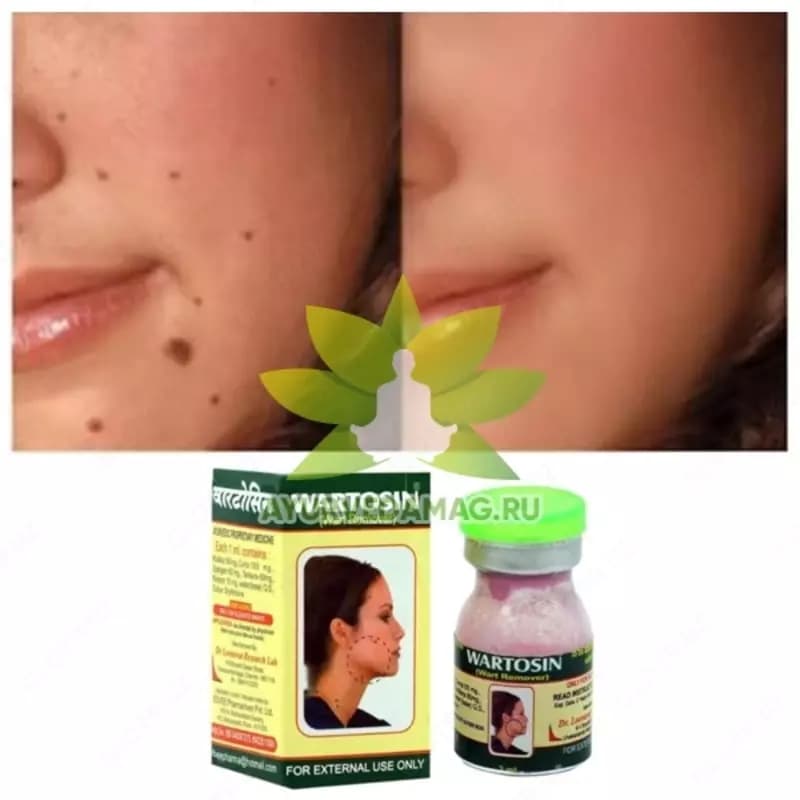 Вартосин от бородавок и папиллом (Wartosin Wart Remover) — 3