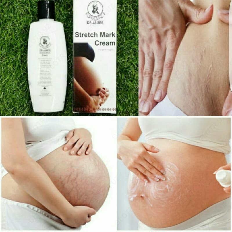 Dr. James Stretch Mark Cream / Крем для устранения растяжек Доктор Джеймс (200 мл) — 1