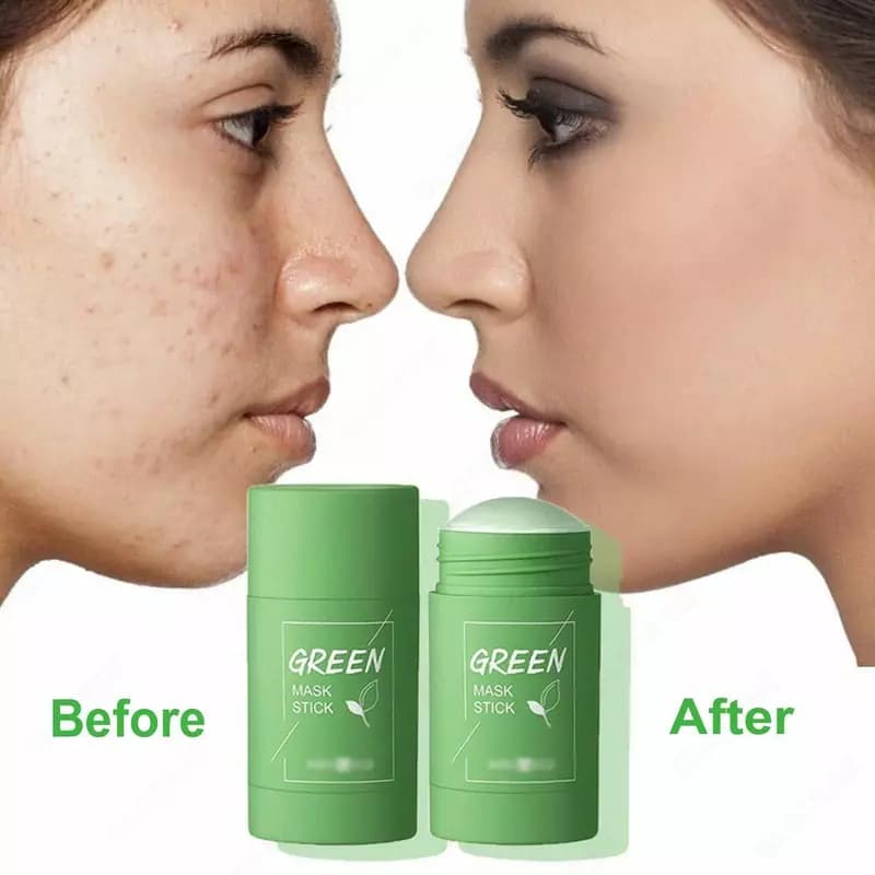 Original Green Mask Stick супер маска для очищения лица — 1