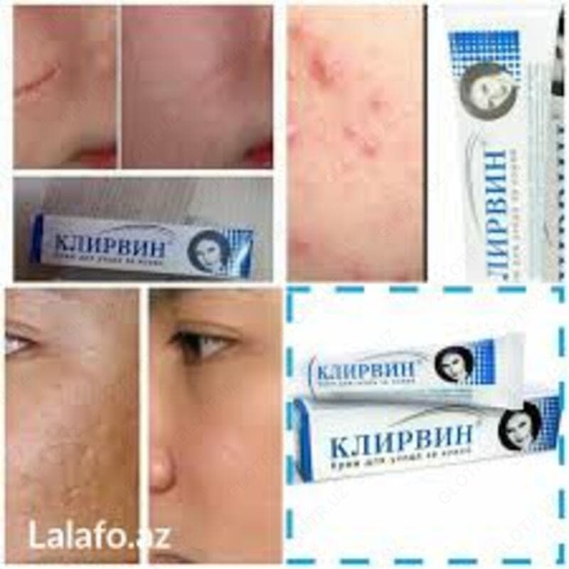 Крем Клирвин от шрамов — 2