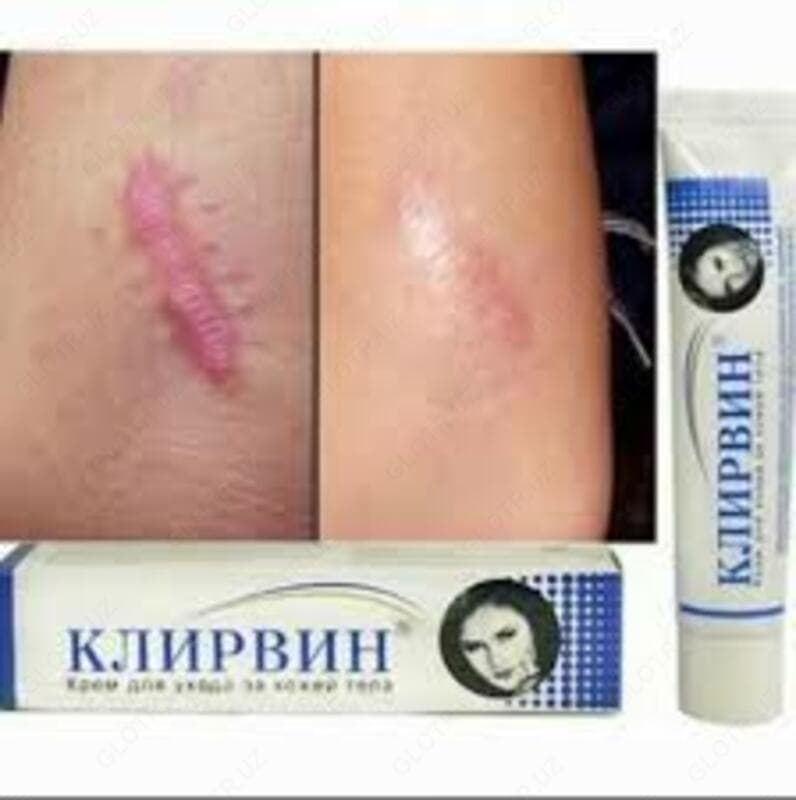 Крем Клирвин от шрамов — 3