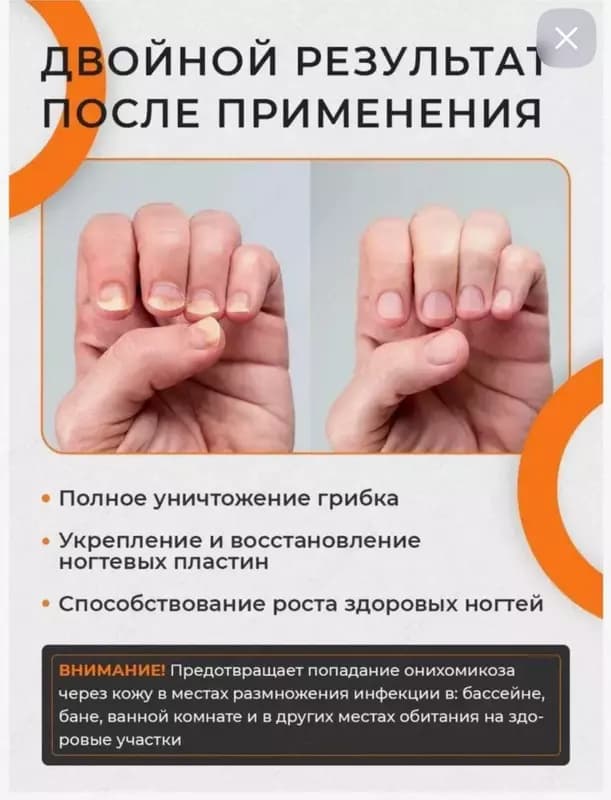 Препарат-сыворотка XI FEI SHIXi Fei Shi от грибка ногтей (15 мл.) — 5