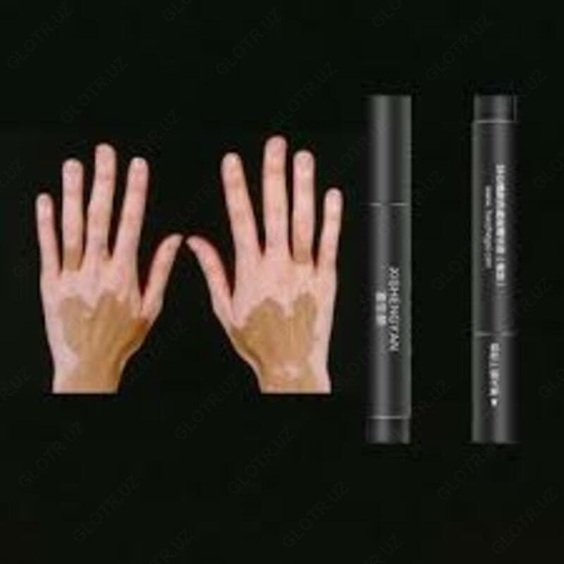 XISHENGYAN flamaster Vitiligo Oq Dog'lar Uchun moljallangan — 2