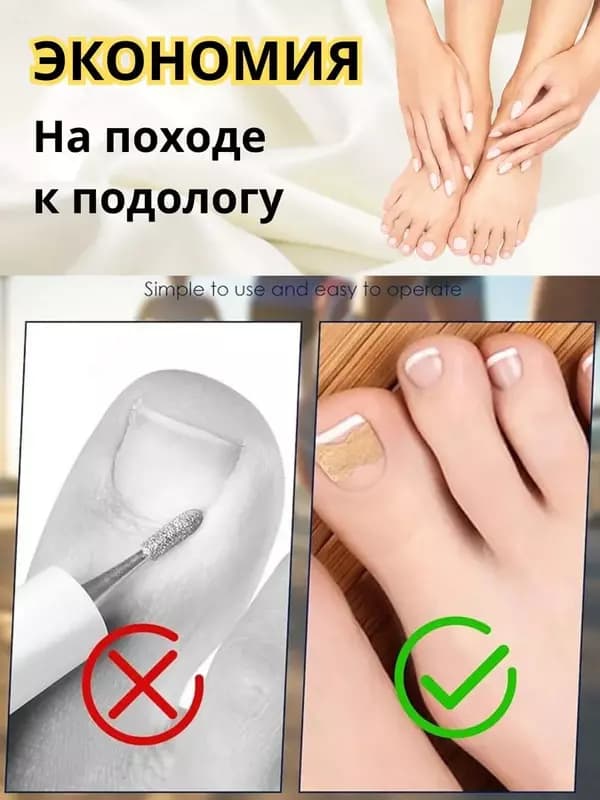 Наклейки для коррекции вросшего ногтя (50 шт). — 2