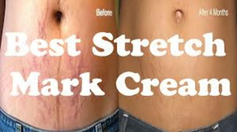 КРЕМ ПРОТИВ РАСТЯЖЕК DANJIA SNAIL REMOVE STRETCH MARKS — 3