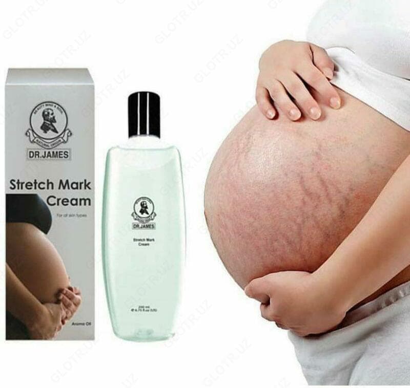 Крем от растяжек Stretch mark cream Dr. James — 2