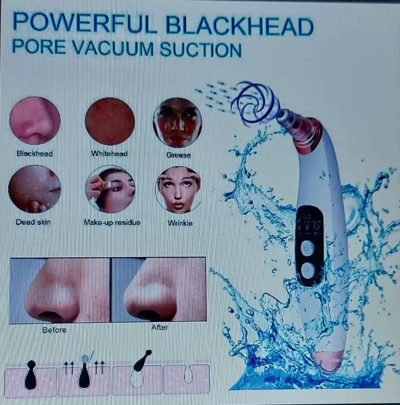 Вакуумный очиститель пор Blackhead Remover — 5