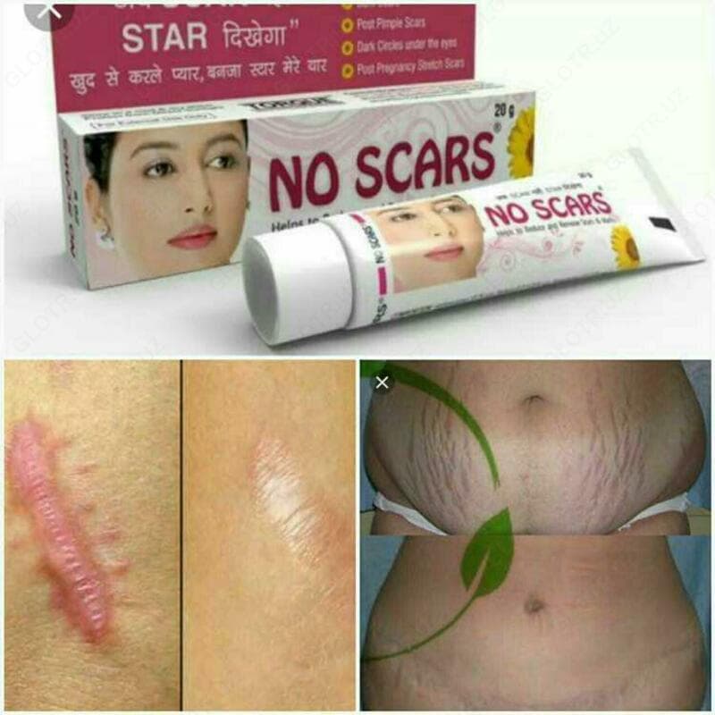 Крем от шрамов и рубцов No scars — 2