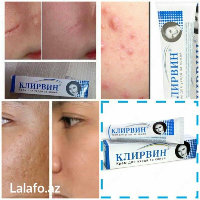 Клирвин крем от прыщей и шрамов — 2