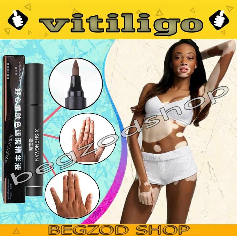 Тональный фломастер от Витилиго Zanderm Vitiligo Concealer — 7