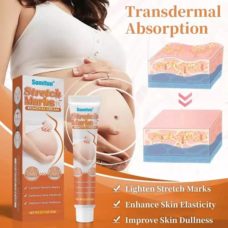 Крем от растяжек Sumifun Stretch Marks Cream 20 g — 1