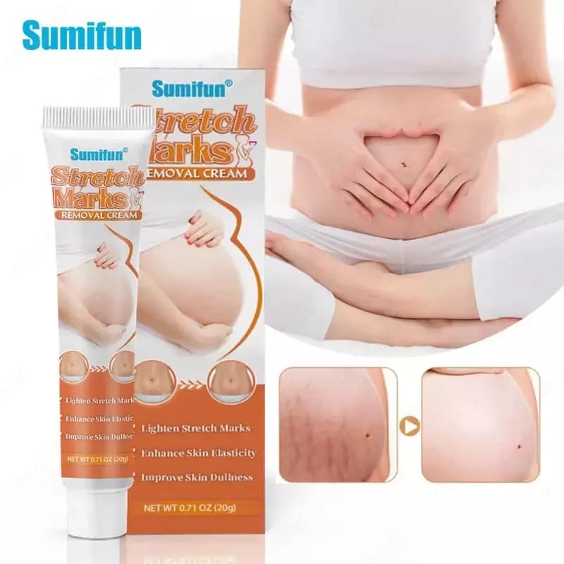 Крем от растяжек Sumifun Stretch Marks Cream 20 g — 2