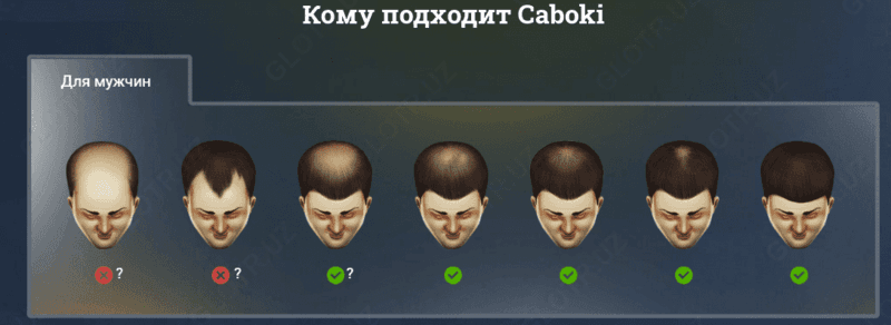 Пудра загуститель волос Toppik (27.5гр) — 8
