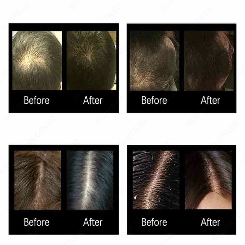 Масло для волос Miracle hair oil — 2
