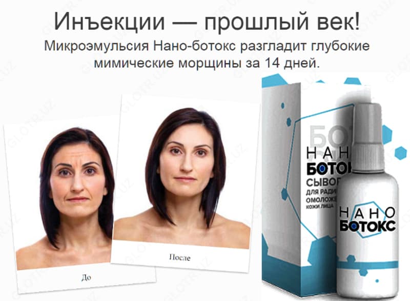 Нано-Ботокс — 5