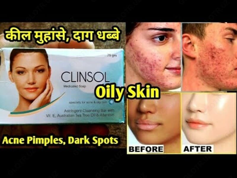 Крем для лица Сlinsol gel — 3