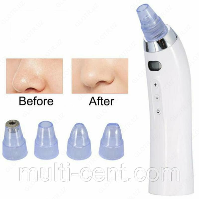 Вакуумный очиститель пор лица Derma Suction — 2