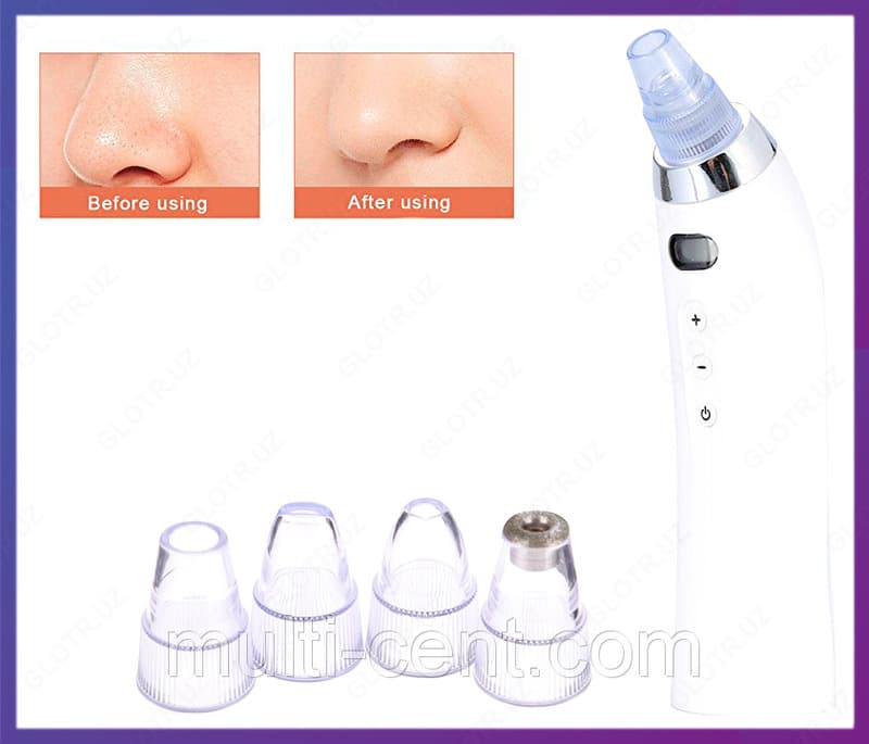 Вакуумный очиститель пор лица Derma Suction — 3
