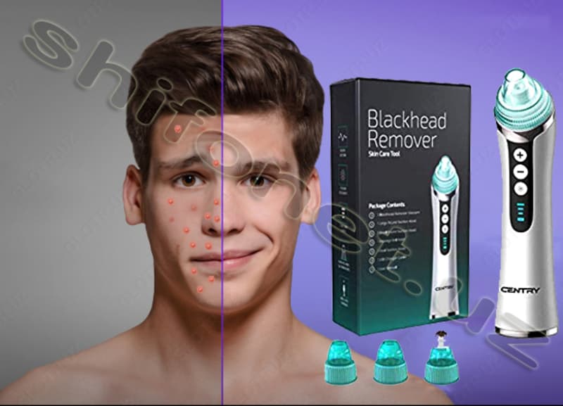 Вакуумный очиститель пор лица Derma Suction — 5