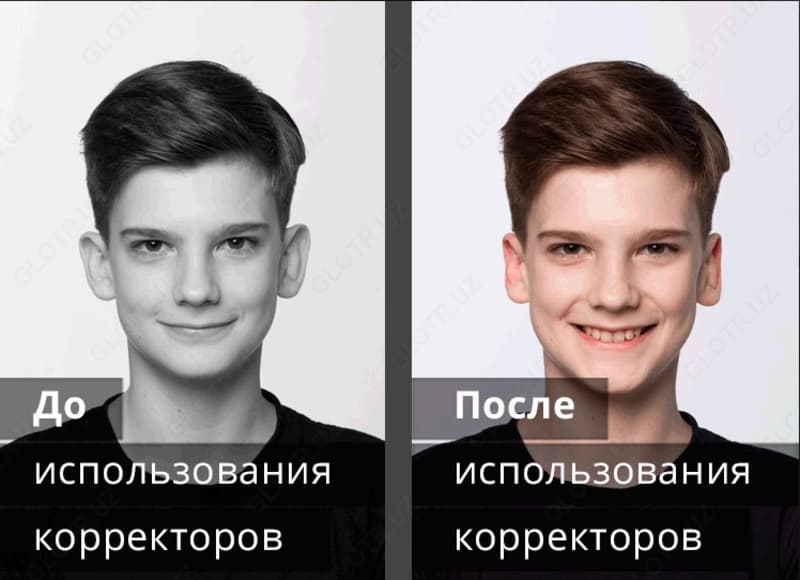 Корректоры для ушей детский — 3