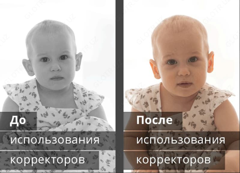 Корректоры для ушей детский — 4