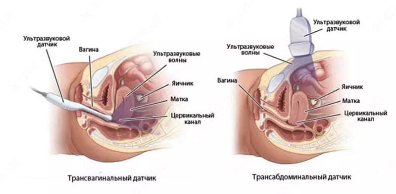 Кабинет ультразвуковой диагностики / УЗИ гинекология малый таз (матки, придатки) — 2
