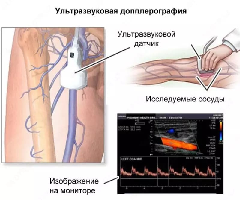 Кабинет ультразвуковой диагностики / УЗИ допплерография вен. Нижней конечности — 2