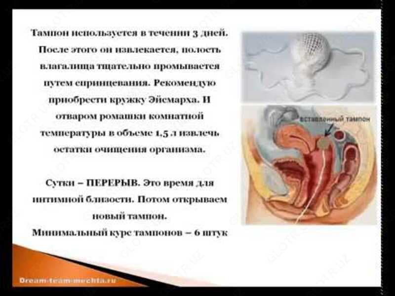Лечебно -профилактические тампоны Beautiful Life Фитотампоны — 2