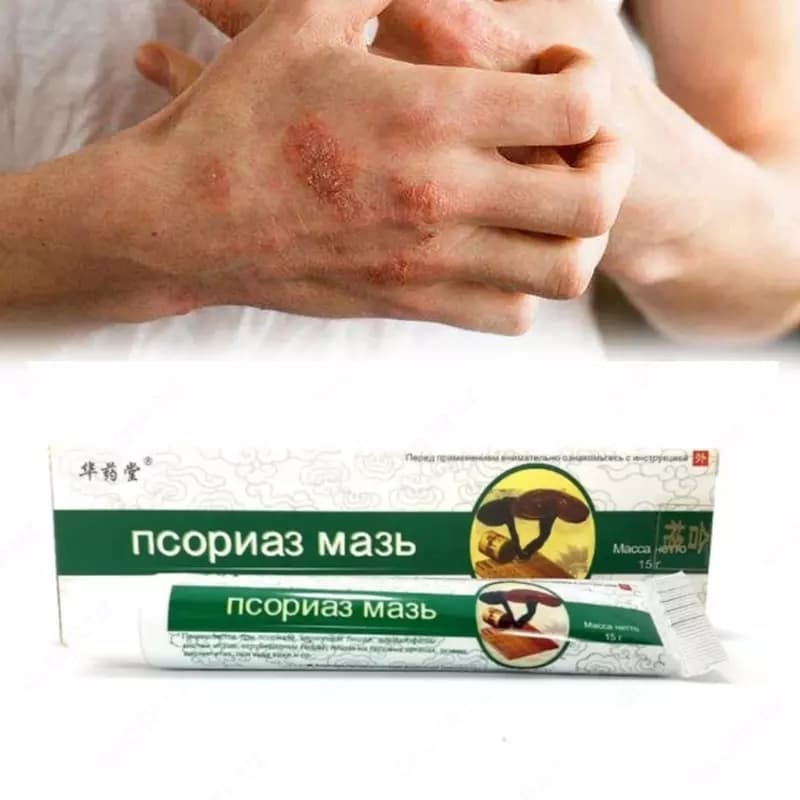 Мазь против псориаза — 3