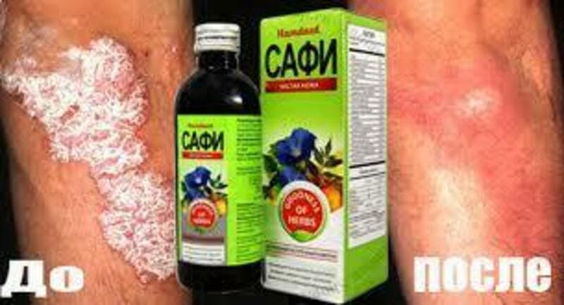 САФИ (SAFI) (СИРОП) 100 МЛ ЧИСТАЯ КОЖА ИНДИЯ В ТАШКЕНТЕ.. — 2