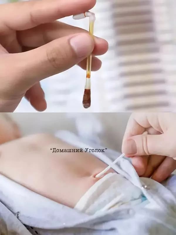 Ватные палочки с йодом (25 шт) — 8