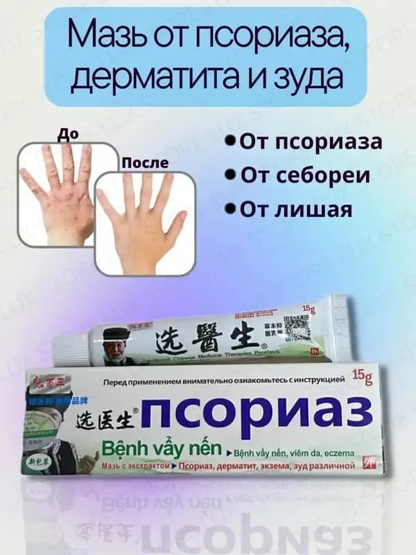 Китайская мазь от псориаза Benh Vay Nen Xuanysheng, 15 гр — 1