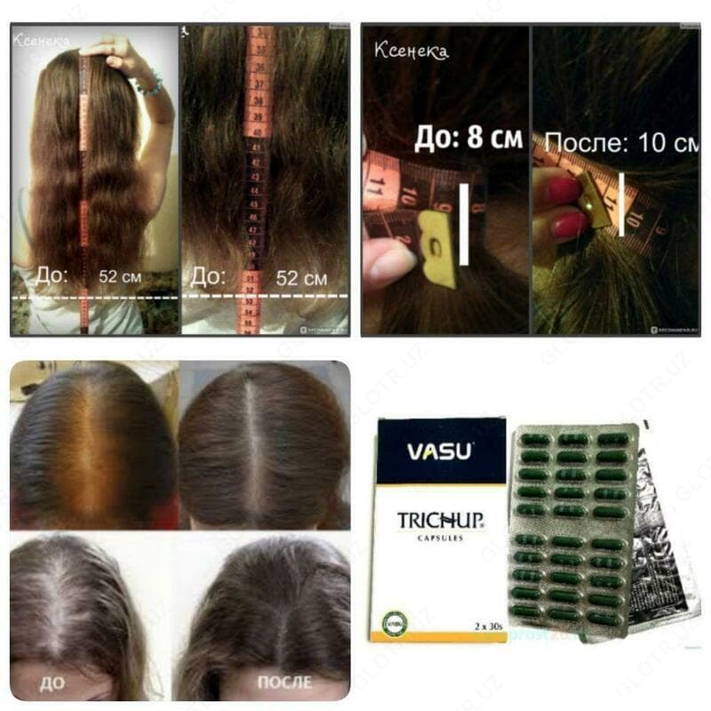 Тричуп таблетки для роста волос (Vasu) — 6