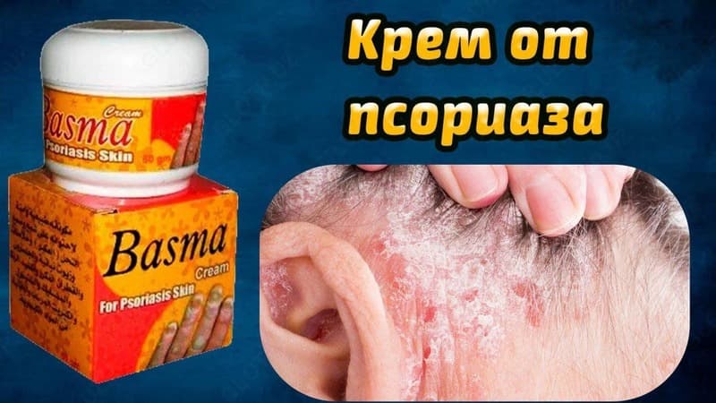 Крем Basma от псориаза — 2