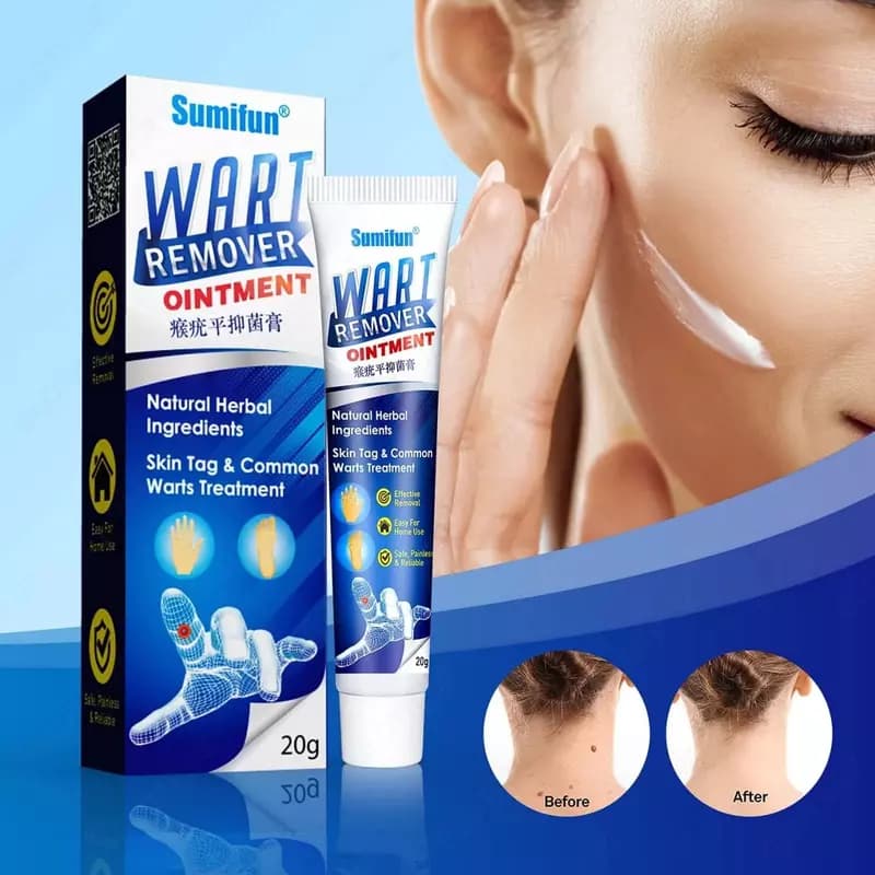 Натуральный крем Sefudun Wart Remover Ointment Ment от бородавок — 2