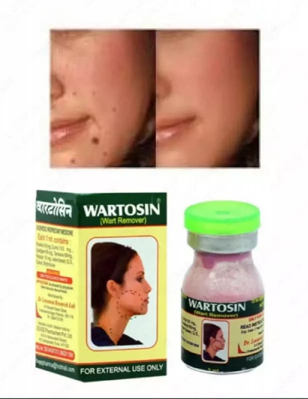 Гель от папиллом Wartosin — 2
