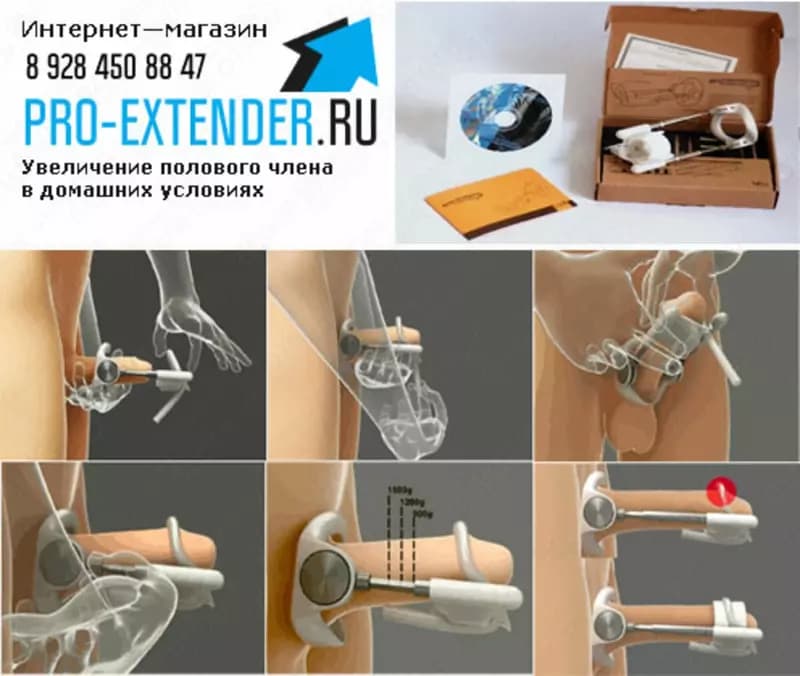 ProExtender для увеличения полового органа — 3