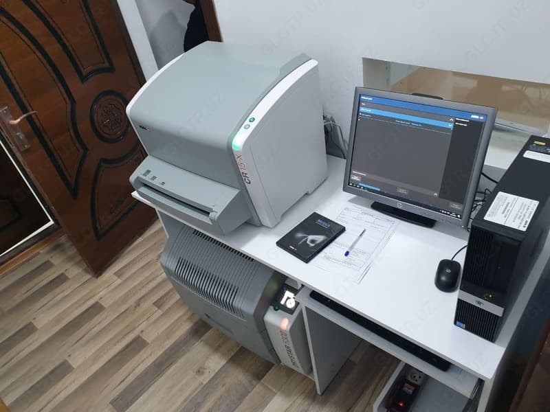 Оцифровщик (дигитайзер) Agfa CR-15X — 5