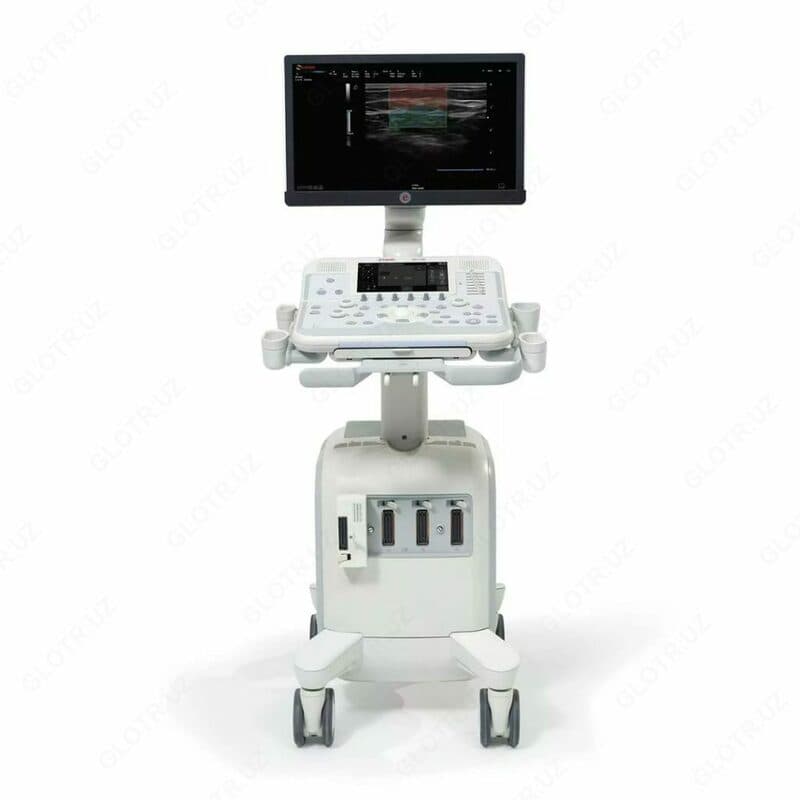 Аппарат УЗИ MYLAB X6 — 1