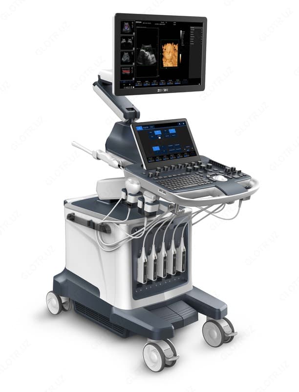 УЗИ Аппарат ViV80 Full Digital Color Doppler Ultrasound System — 1