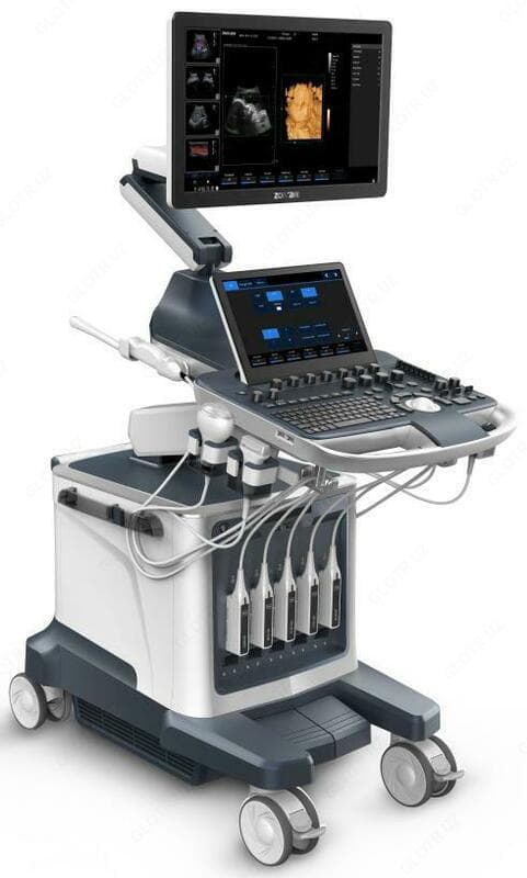 УЗИ Аппарат ViV80 Full Digital Color Doppler Ultrasound System — 2