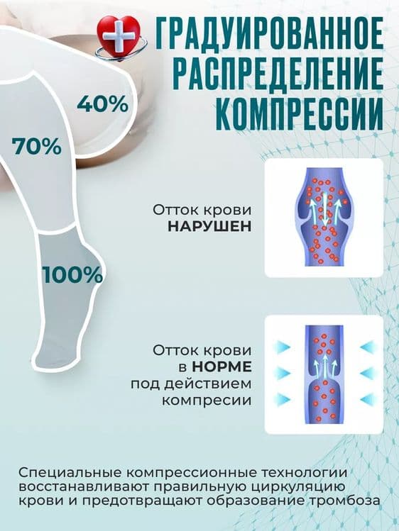 Компрессионные чулки 1 класс для родов беременных после операции — 4