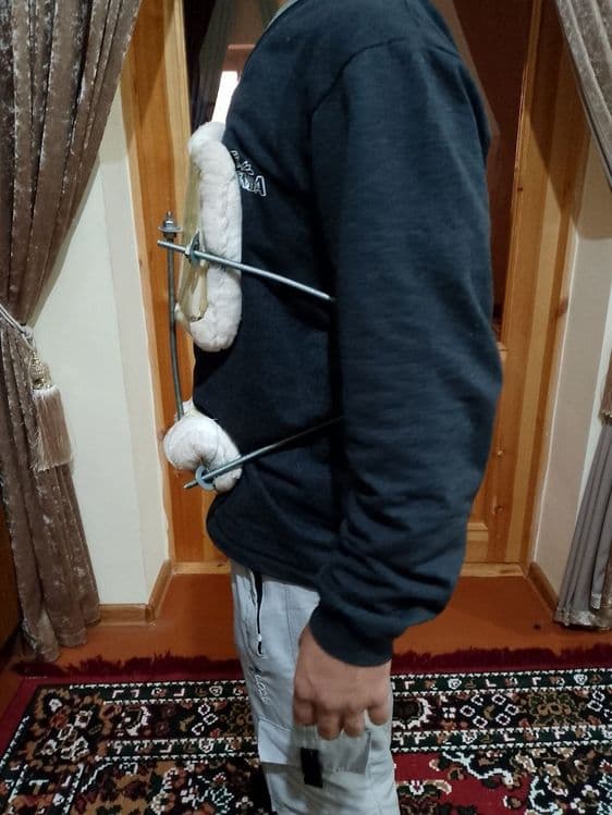 Korset xolati ideal 2 oy ishlatilgan umurtqa uchun — 3