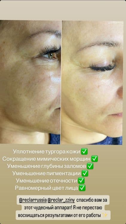 Re - merge лучший подарок чтоб твоя кожа была здоровой и сияющей — 5