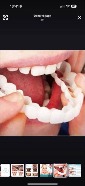 виниры для зубов съемные — 1