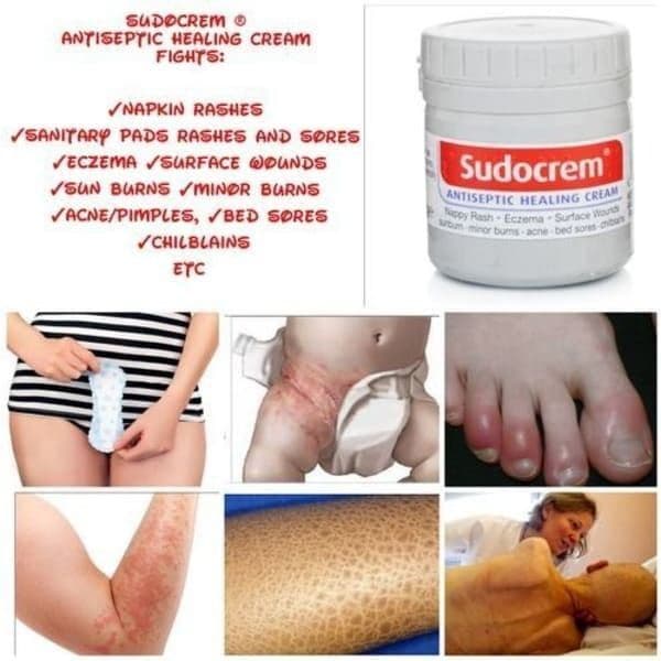 Sudocrem хар хил тошмалар,кизариш,яра,мозол,угри,аллергияга карши — 1
