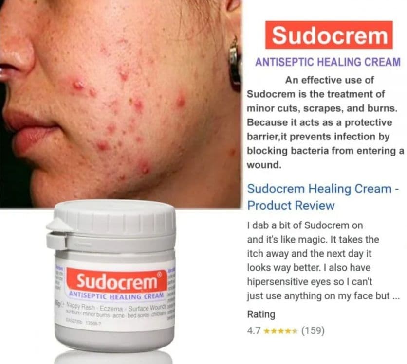 Sudocrem хар хил тошмалар,кизариш,яра,мозол,угри,аллергияга карши — 4